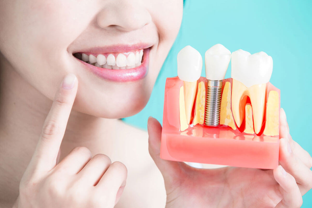 Dental Implants: Right for me?