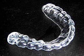 Mouthguard Use Encouraged During Summer Activities